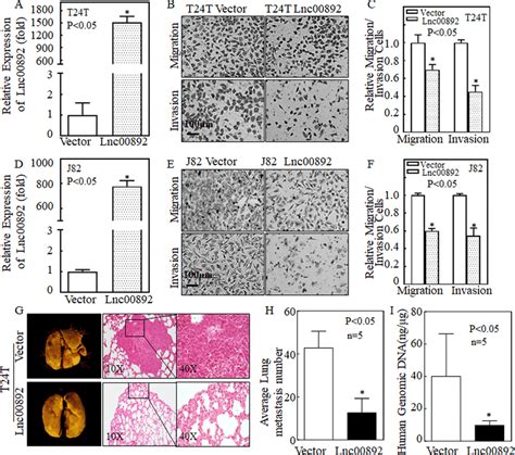 Lnc Inhibition Of Bladder Cancer Cell Invasion In Vitro And In