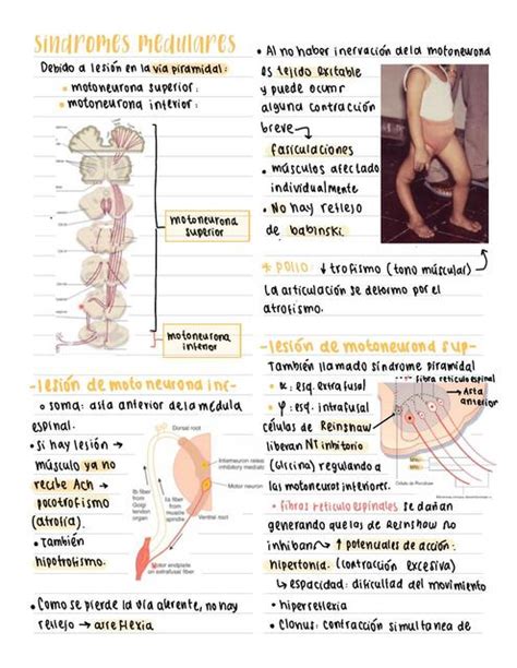 Síndromes Medulares DocsNotes uDocz