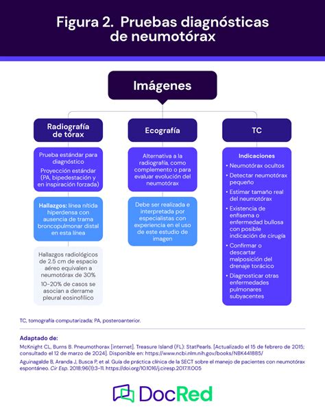 Gpc Gu A De Diagn Stico Y Tratamiento De Neumot Rax