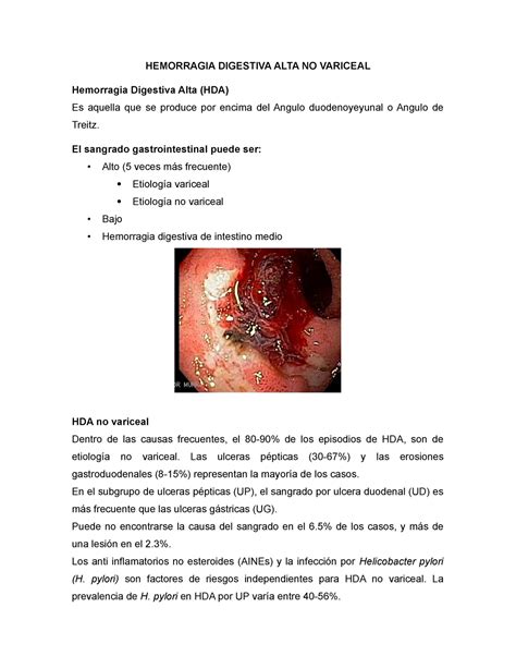 Assinale A Opção Correta Acerca Da Hemorragia Digestiva Alta Hda LIBRAIN