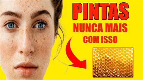 Como Eliminar Pintas No Rosto De Forma Natural YouTube