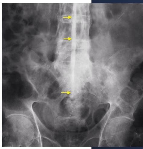 Clin Skills Msk Imaging Flashcards Quizlet