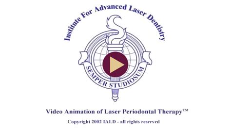 Laser Assisted New Attachment Procedure Lanap In Santa Fe Nm Vida