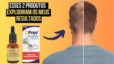 ESSES 2 PRODUTOS ACABOU A MINHA QUEDA DE CABELO E CALVÍCIE