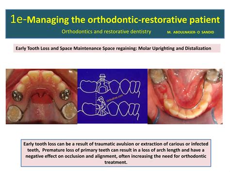interdisciplinary treatment in orthodontics dr olivier sandid