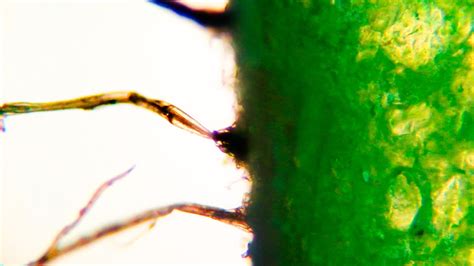 Kiwi Under The Microscope Hairy Kiwifruit Youtube