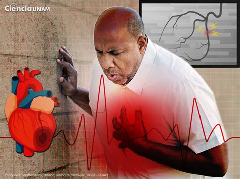 Atención oportuna lo mejor para un buen pronóstico en infarto agudo al