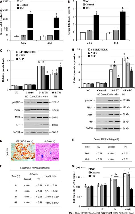 Figure 1 From Intracellular Alpha Fetoprotein Mitigates Hepatocyte