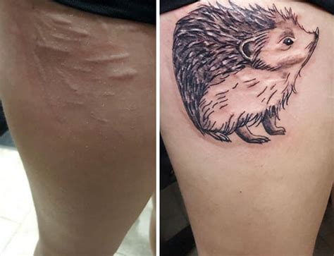 25 Beautiful Tattoos That Transformed Scars Into Artworks