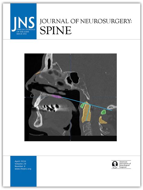 Patterns Of Epidural Progression Following Postoperative Spine