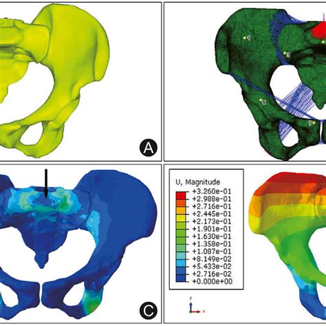 Seven Functional Fixation Zones Of Pasp Are Divided And Identified By