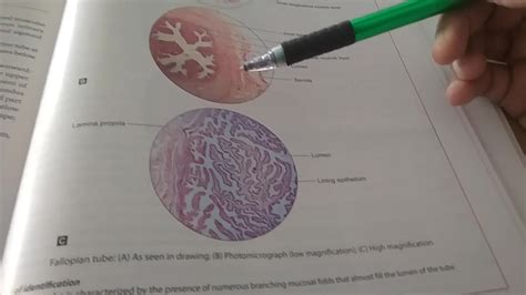 Inderbir Singh S Textbook Of Human Histology With Color