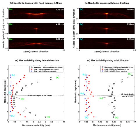 Ultrasonic Needle Tracking With Dynamic Electronic Focusing