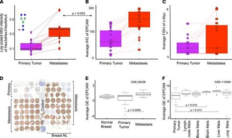 JCI Insight Clinical Importance Of High Mannose Fucosylated And