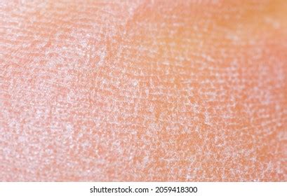 Skin Texture Pattern Background Stock Photo 2059418300 | Shutterstock