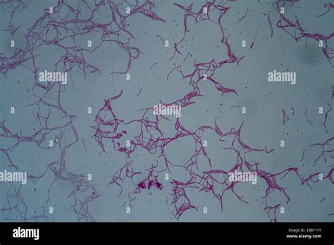 Bacillus Anthracis Fotograf As E Im Genes De Alta Resoluci N Alamy