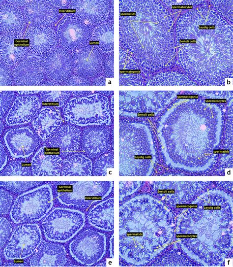 Representative Photomicrographs Of Testicular Structure Comprising The