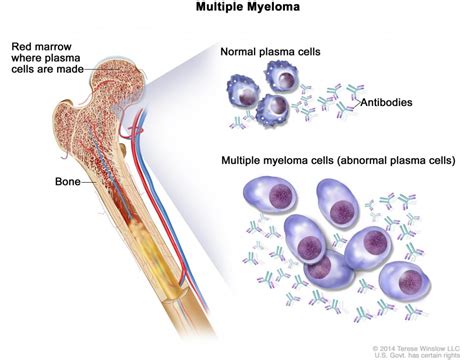 Study Explores Relationship Between Precursor Conditions And Multiple