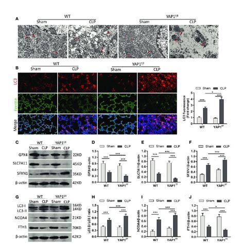 Yap Deficiency Aggravated Clp Induced Ferroptosis And Ferritinophagy