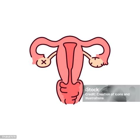 Uterine Myoma Color Line Icon Gynecology Problem Stock Illustration