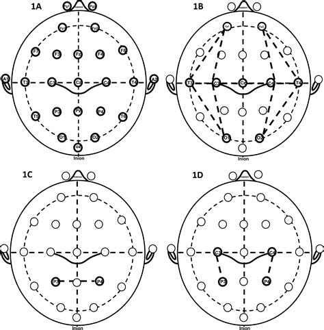 Amplitude Integrated Electroencephalography In Neonates Pediatric