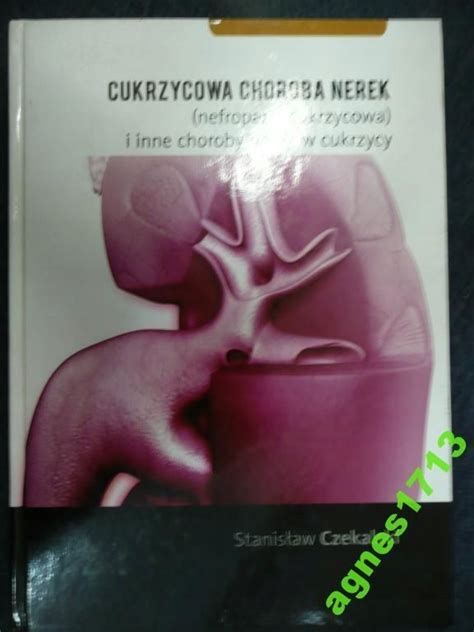 Cukrzycowa choroba nerek i inne choroby nerek 7843398852 Książka