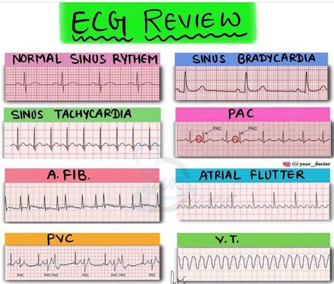 ECG Review MEDizzy