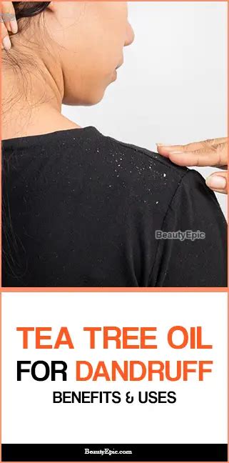 Tea Tree Oil For Dandruff: Uses And Benefits