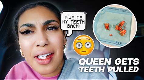 Queen Gets Her Wisdom Teeth Removed Youtube