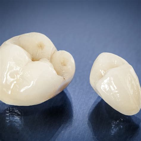 Dental Crowns Cap Shaped Like A Tooth To Provide Protection