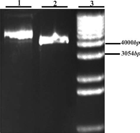 Double Digestion Of PET 28a Expression Vector With Restriction