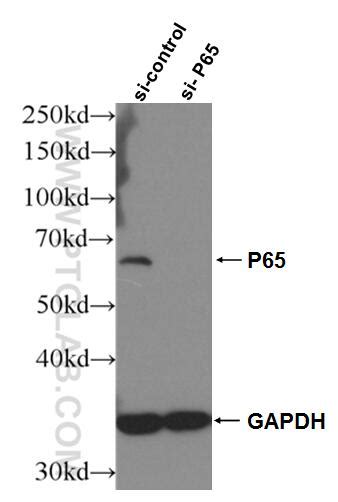 Nf κb P65 Antibody 66535 1 Ig Proteintech 武汉三鹰生物技术有限公司