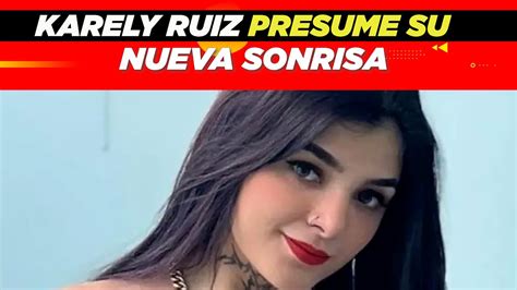 Así luce Karely Ruiz con su nueva sonrisa YouTube