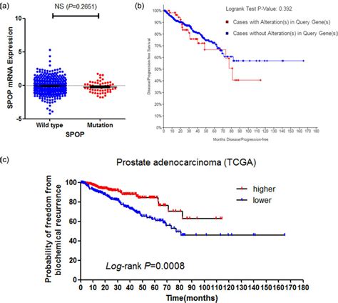 Spop Mrna Level But Not Mutations Of Spop Associated With Pca