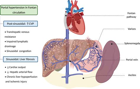 Abdominal Ct And Mri Findings Of Portal Hypertension In Children And