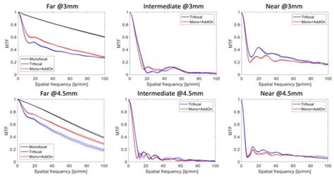 Diagnostics Free Full Text Comparison Of A Presbyopia Correcting Supplementary Intraocular