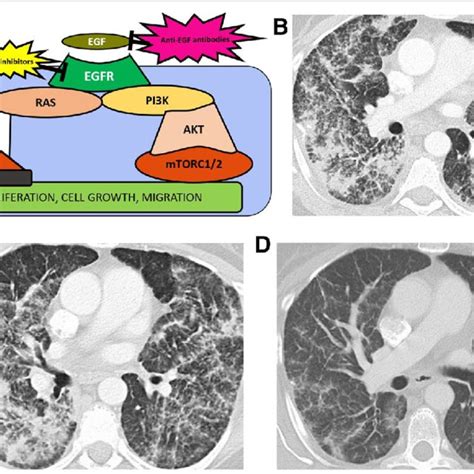 Intratumoral Heterogeneity A Image Exemplifying The Heterogeneity