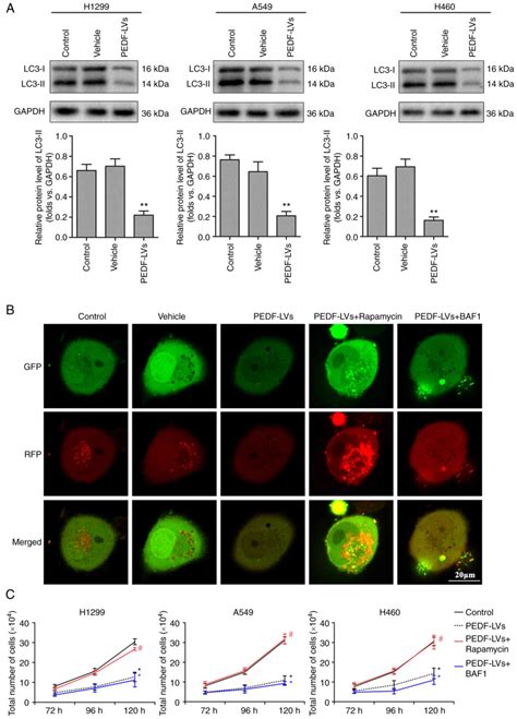 PEDF Inhibits Nonsmall Cell Lung Cancer Proliferation By Suppressing