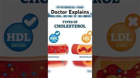 Good Cholesterol Vs Bad Cholesterol Youtube