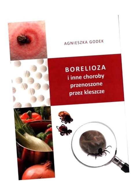 BORELIOZA I INNE CHOROBY PRZENOSZONE PRZEZ 12612512094 Książka