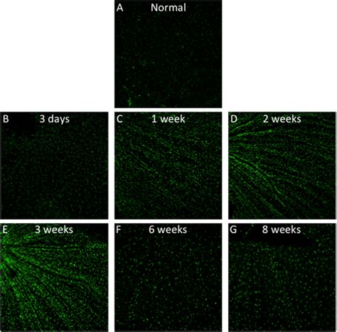 Retinal Whole Mount Immunostaining Of Microglial Cells At Different