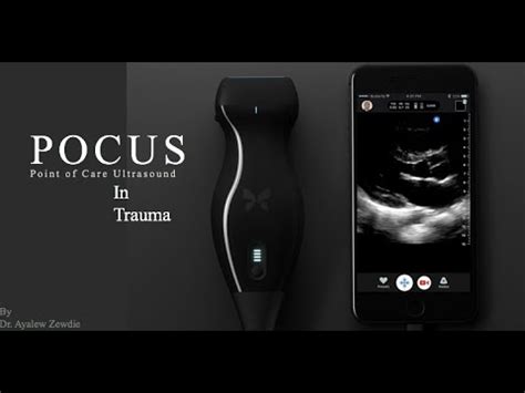 POCUS Point Of Care Ultrasound YouTube