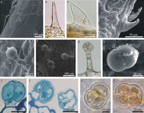 Figure 1 From HISTOCHEMICAL INVESTIGATION OF TRICHOMES AND CHEMICAL