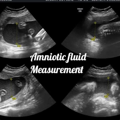 Normal 34 Week Pregnancy And Ultrasound Your Complete Guide