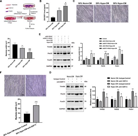 The Gdf Is Involved In Myotube Atrophy Induced By Cm From Paec A