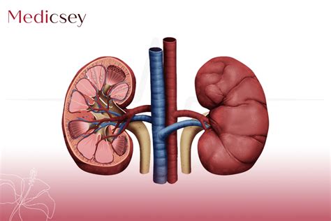 Kidney Transplant