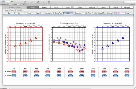 Audiogram Aided - HearForm Features - HearForm