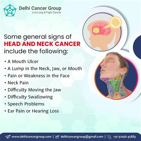 Comprehensive Guide To Head And Neck Cancer Types Symptoms And