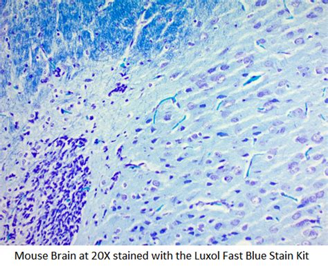 Luxol Fast Blue Histology Stain Kit