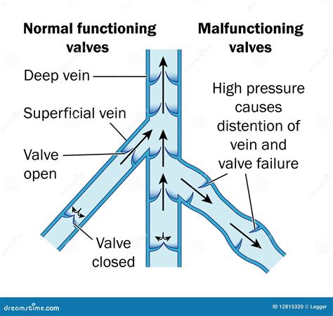 Normal Vein Cartoon Vector 35601437